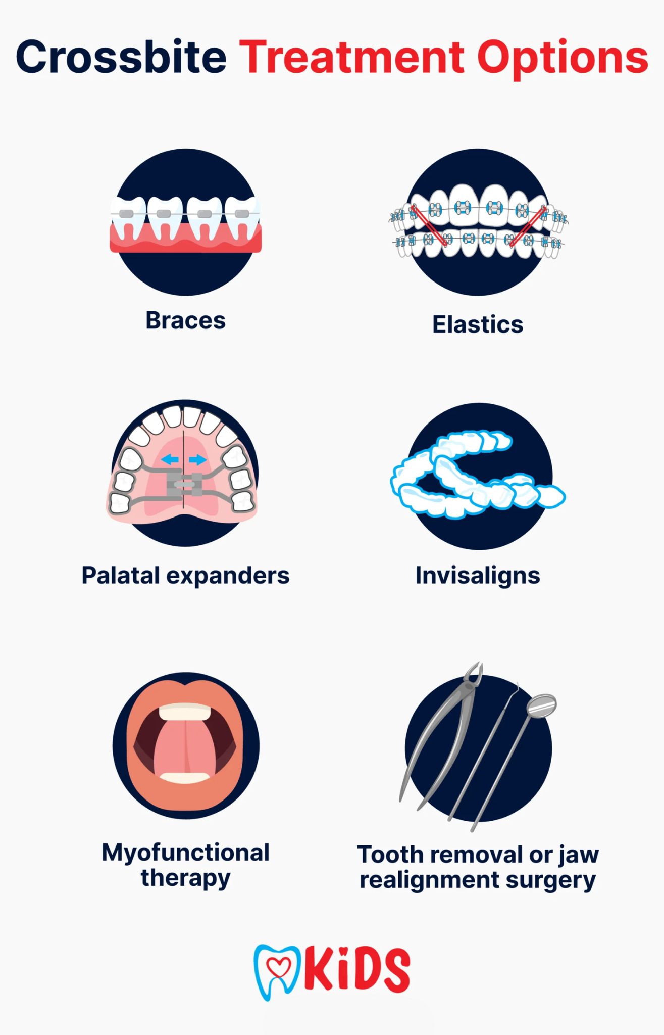 Crossbite treatment options
